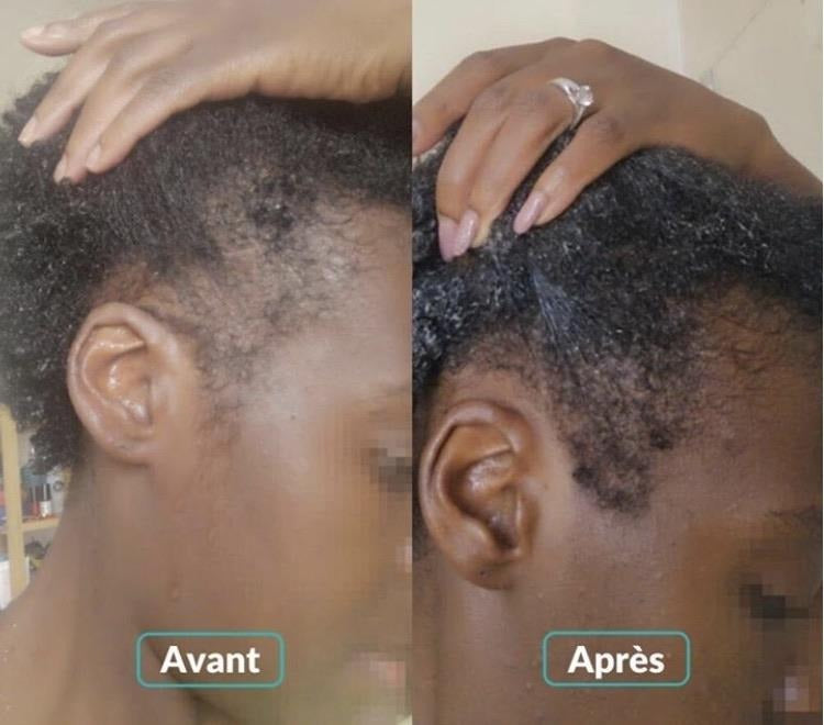 Huile essentielle pousse cheveux